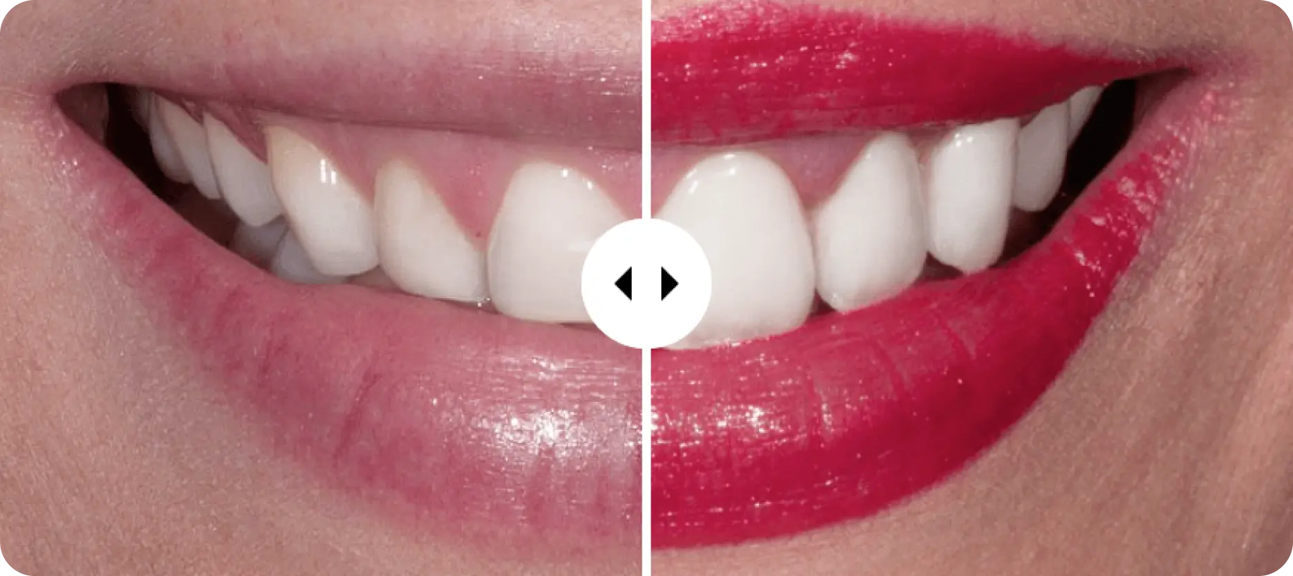 Dientes