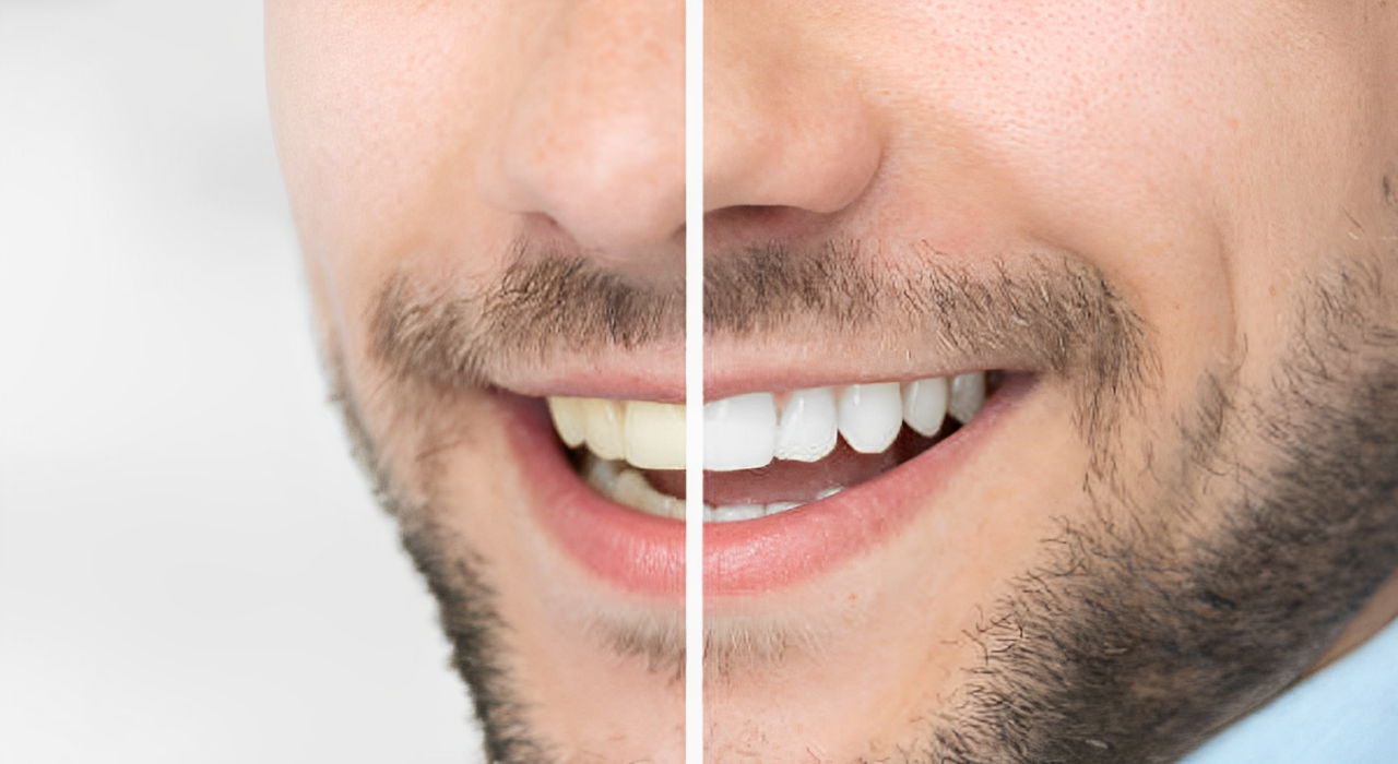 Dientes